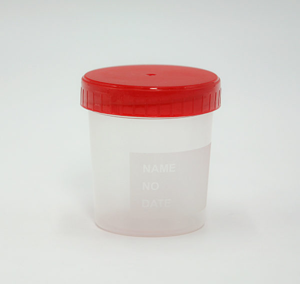 contenitore urina 100 ml
